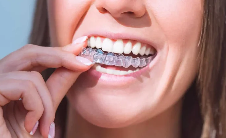 A woman wearing Retainers