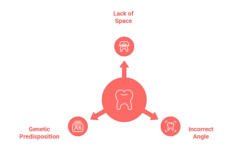 Causes of a Horizontally Impacted Wisdom Tooth