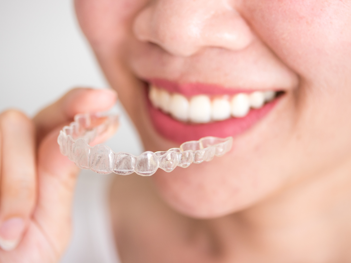 Can Invisalign Fix an Underbite